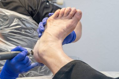 Donanım pedikürü, ayağı aşındırıcı bir diskle zımparalamak..