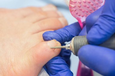 Donanım pedikürü, ayak parmaklarından eski derinin alınması..