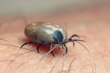 Kana bulanmış bir kene insan derisinde sürünür..