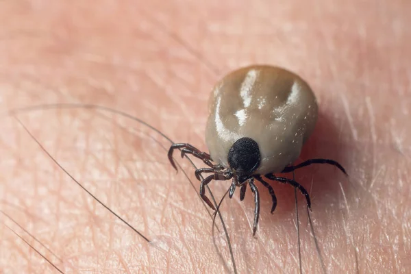 A tick drunk on blood crawls on human skin.