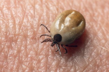 Kana bulanmış bir kene insan derisinde sürünür..