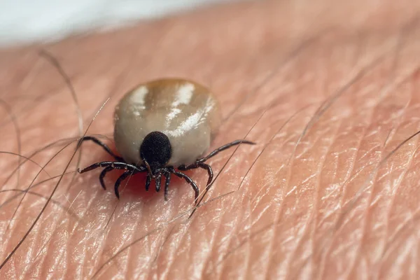 Una Garrapata Borracha Sangre Arrastra Sobre Piel Humana — Foto de Stock