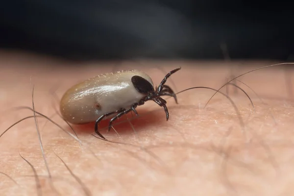 Una Garrapata Borracha Sangre Arrastra Sobre Piel Humana — Foto de Stock