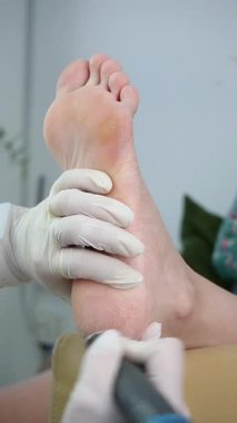 Podolojist, müşterinin topuğuna ofiste donanım tedavisi uygular.