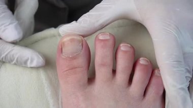 Doktor pediatrist ameliyattan önce hastanın ayak tırnağını muayene eder.