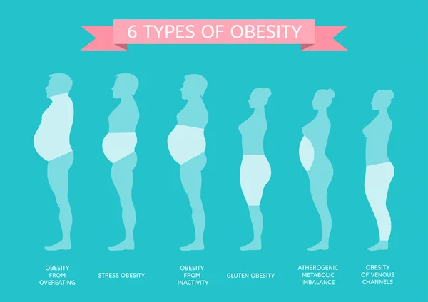 6 Tipos de Obesidad — Archivo Imágenes Vectoriales