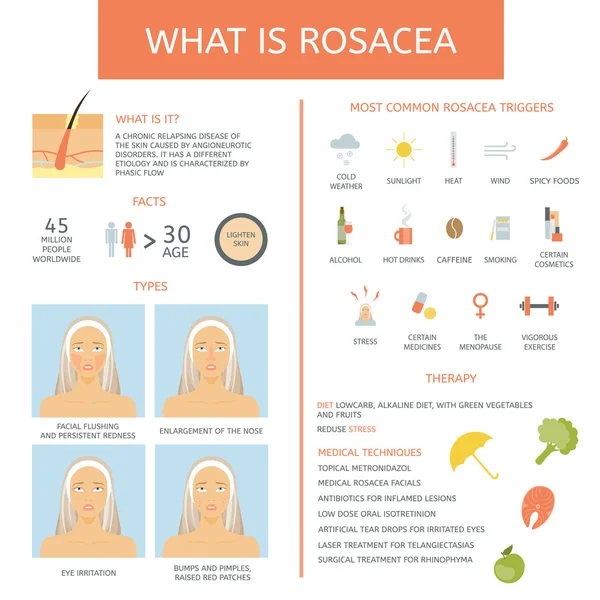 Rosacea: příčiny, typy, terapie a fakta. — Stockový vektor