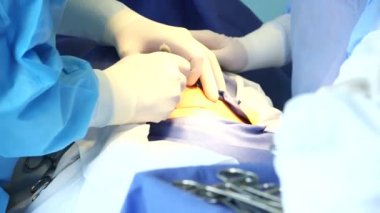 Yapım sezaryen doktor