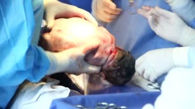 Yapım sezaryen doktor