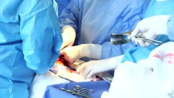 Chirurg maken van Cesarean afdeling — Stockvideo