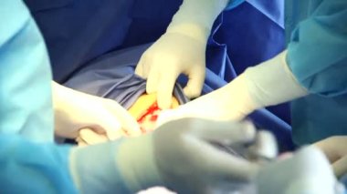 Yapım sezaryen doktor