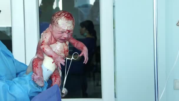 Orvos-val gyermek császármetszés után — Stock videók