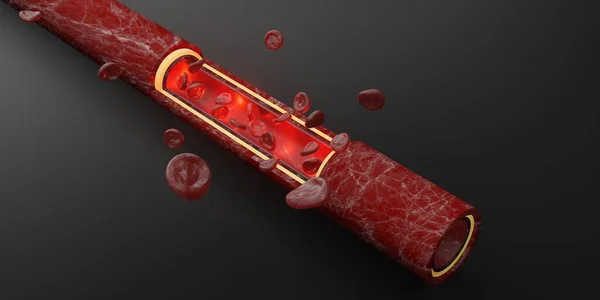 Glóbulos Vermelhos Pele Camada Veias Ilustração Intravascular Cirurgia — Fotografia de Stock