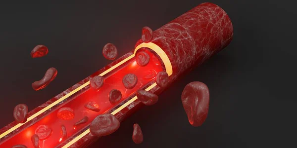 red blood cells skin layer veins 3d illustration intravascular surgery