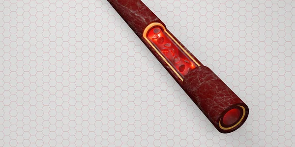 Czerwonych Krwinek Skóry Warstwa Żyły Ilustracja Wewnątrznaczyniowego Chirurgii — Zdjęcie stockowe