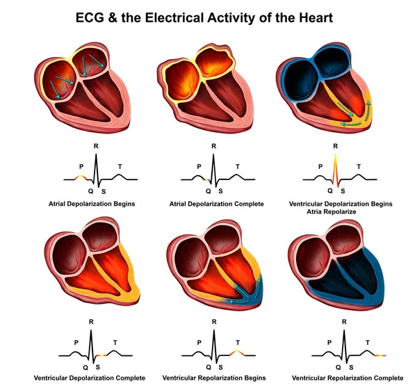 Illustration Médicale Ecg Expliqué — Photo