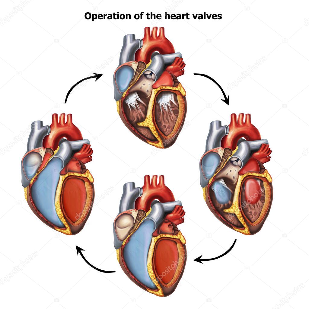  Medical illustration of  Open Heart  valves operation
