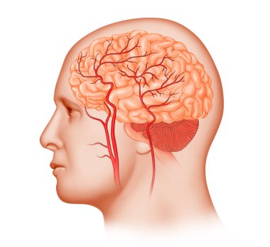 Beyin damarlarının tıbbi örnekleri.