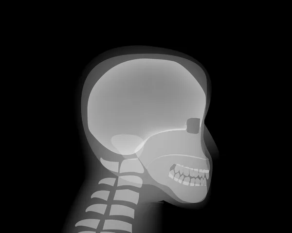Side view Human head skull on x-ray film — Stock Illustration Side view Human head skull on x-ray film Royalty Free Stock Vectors