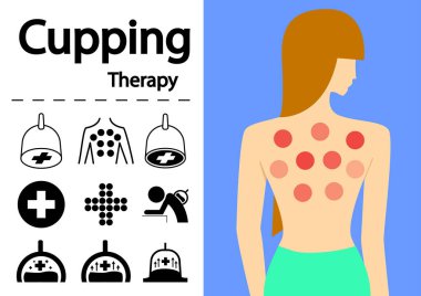 Düz vektör sanat tasarımında Hijama ya da Cupping Terapi Simgeleri