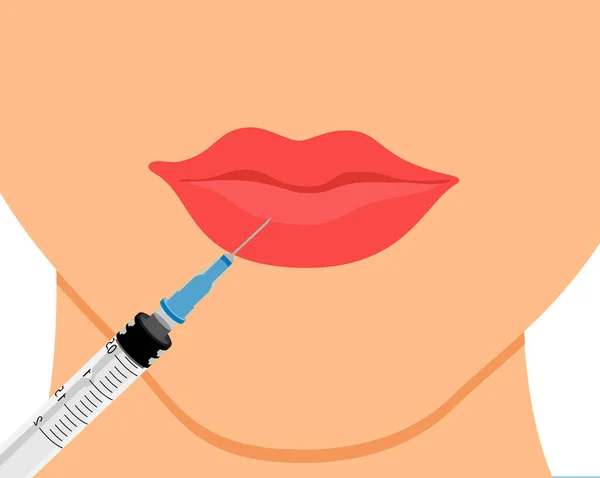 性感美丽的女性唇 程序唇注射 妇女嘴附近的注射器 增加嘴唇形状的注射剂 皮肤科和美容疗法的病媒说明概念 — 图库矢量图片