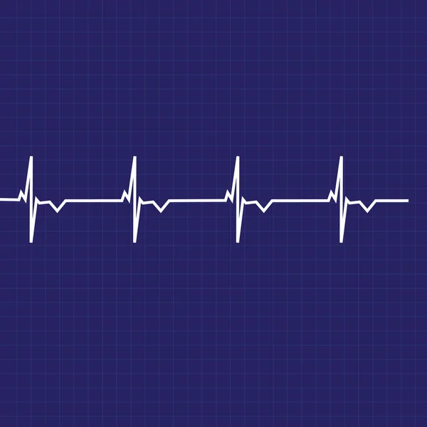 Ekg line — Stock Vector