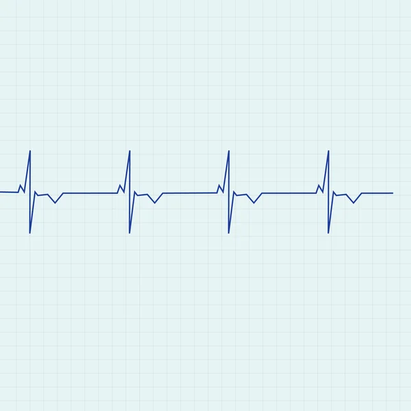 Ekg-Linie — Stockvektor