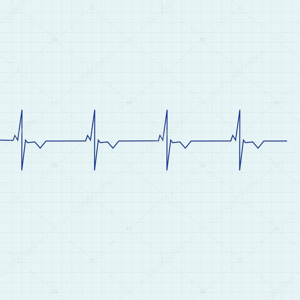 Ekg line