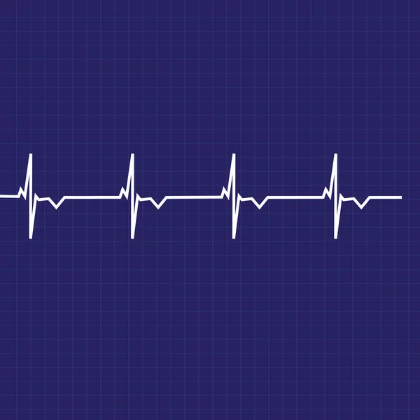 EKG-linjen raster — Stockfoto