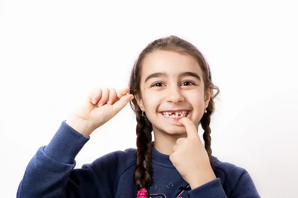 A queda dos primeiros dentes de leite — Fotografia de Stock