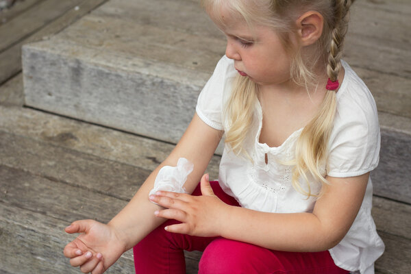 Girl applying dermatology cream