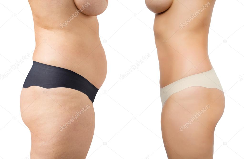 Before and after weight loss