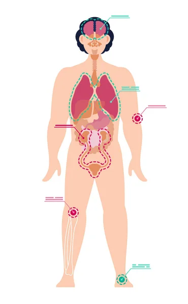 Hombre de cuerpo entero con designación de puntos de dolor — Vector de stock