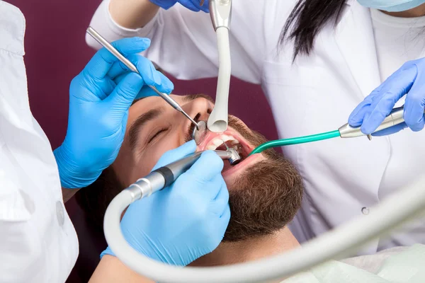 Cierre de los hombres paciente con la boca abierta en la clínica dental — Foto de Stock