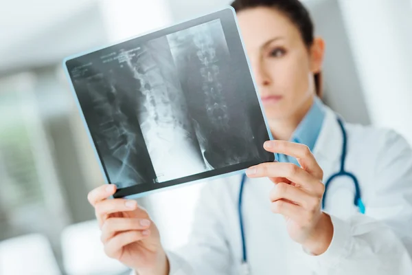 Kvinnliga läkare undersöka en röntgenbild — Stockfoto