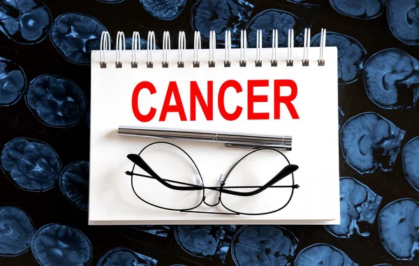 Texto Cancer Fondo Resonancia Magnética Concepto Médico — Foto de Stock