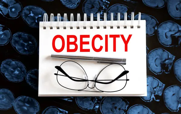 Text Obesity Auf Mri Hintergrund Medizinisches Konzept — Stockfoto