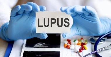 text LUPUS write on a medicine card. Medical concept with a stethoscope, pills