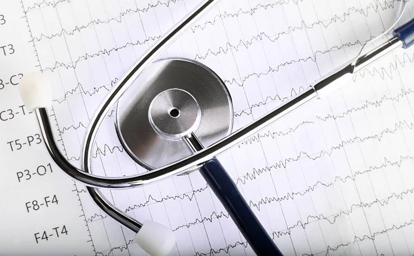 Kék Sztetoszkóp Elektrokardiogram Ekg Térképén Ekg Szívdiagram Vizsgálat Izolátum Fehér — Stock Fotó