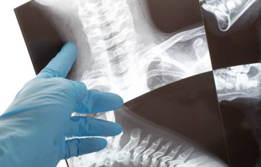 Doktor el MR 'da bir şey gösteriyor. Manyetik rezonans terapisi sonucu.