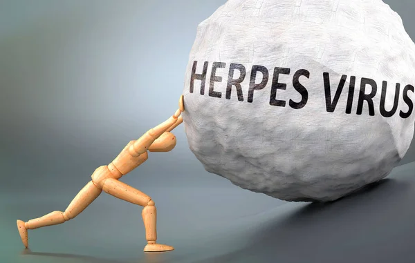 Herpes Virus Und Schmerzhaftes Menschliches Leiden Dargestellt Als Hölzerne Menschliche — Stockfoto