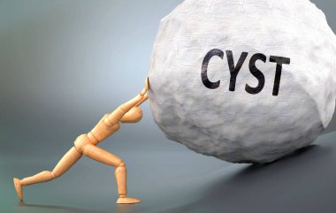 Kist ve acı verici insanlık hali, insan hayatında Kist 'le başa çıkmanın ne kadar zor olduğunu göstermek için ağırlığı zorlayan ahşap bir insan figürü olarak resmedilmiş, 3D çizim.