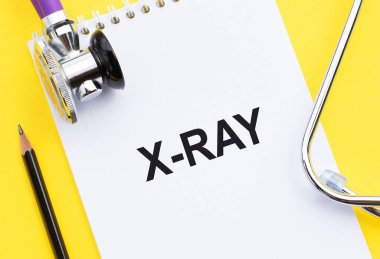 X-RAY kelimesi tıbbi not defterine stetoskopla birlikte yazılmış..