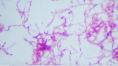 Adam laboratuarda bakterili fotoğraf ve Petri kabı gösteriyor.