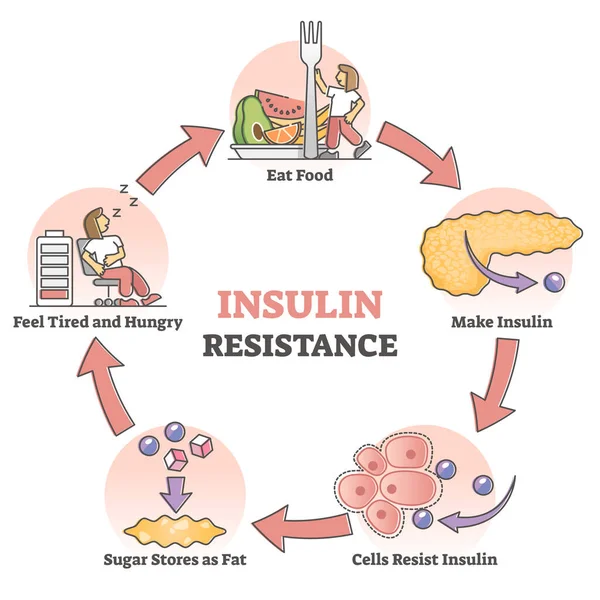 Insulin resistance pathological health condition educational outline diagram — Stock Vector