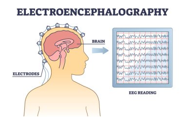 Elektroensefalografi ya da EEG beyin aktivitesi şemasını izlemek için kullanılır.