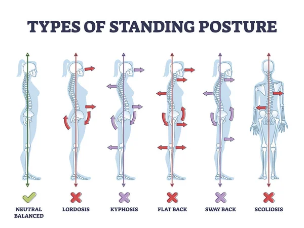 Types de postures debout et pathologie du dos médical schéma de contour — Image vectorielle