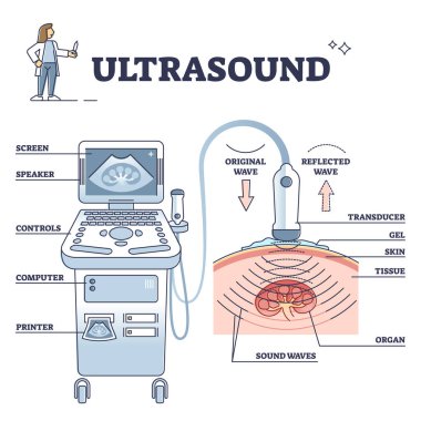 Ultrason hasta analiz süreci ve ekipman açıklaması şeması