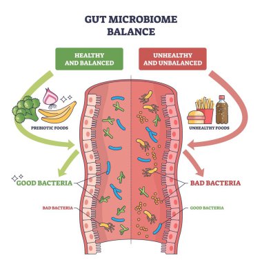 Bağırsak mikrobiyomu dengesi, iyi ve kötü bakterileri, prebiyotik gıdaları ve abur cuburun yol gösterici sonuçlarıyla gösteren bölünmüş bir bağırsak ile ortaya çıkar. Özet diyagramı