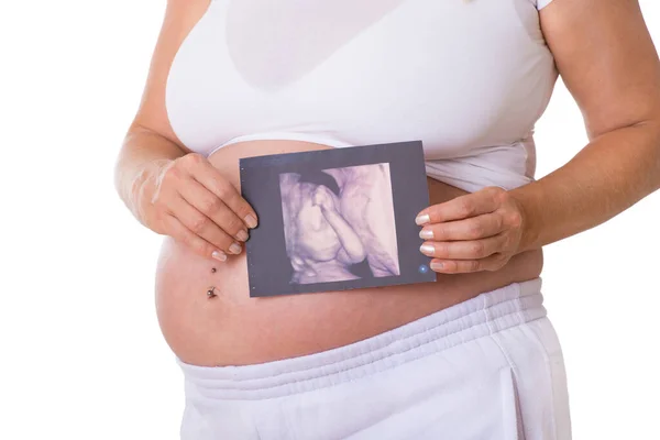 Kobieta Ciąży Trzyma Obraz Ultradźwiękowy Rękach — Zdjęcie stockowe